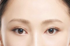 韩式三点定位双眼皮价格影响因素