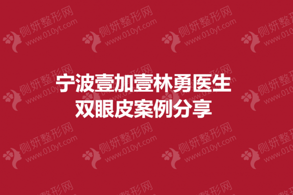 宁波壹加壹林勇医生双眼皮分享