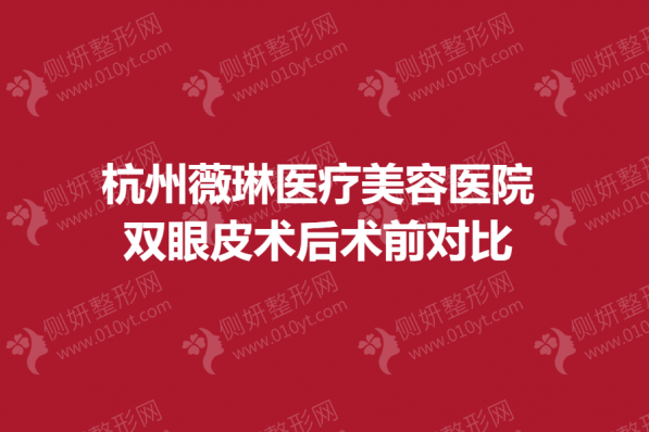 杭州薇琳医疗美容医院推荐
