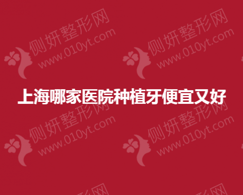 上海哪家医院种植牙便宜又好