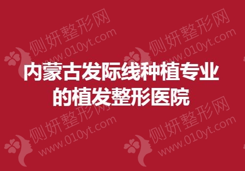 内蒙古发际线种植专业的植发整形医院