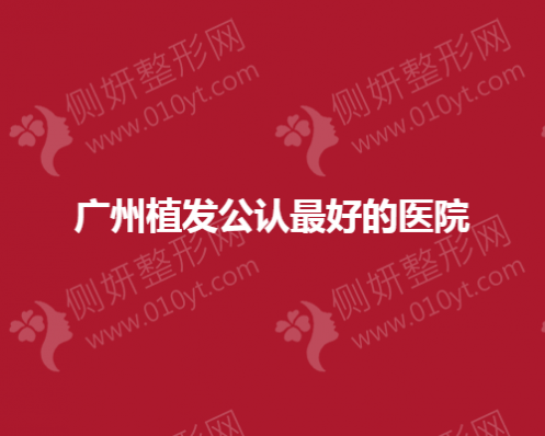 广州植发公认最好的医院分享