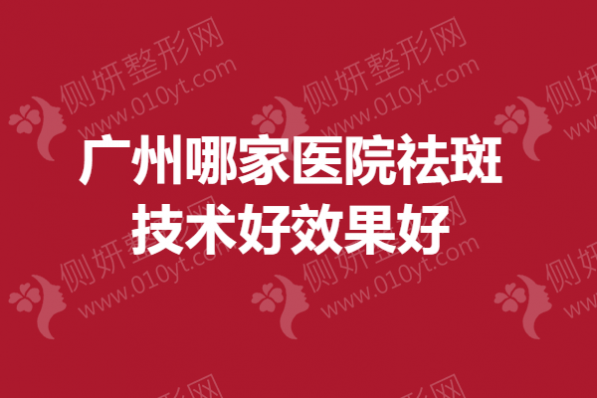 广州哪家医院祛斑技术好效果好