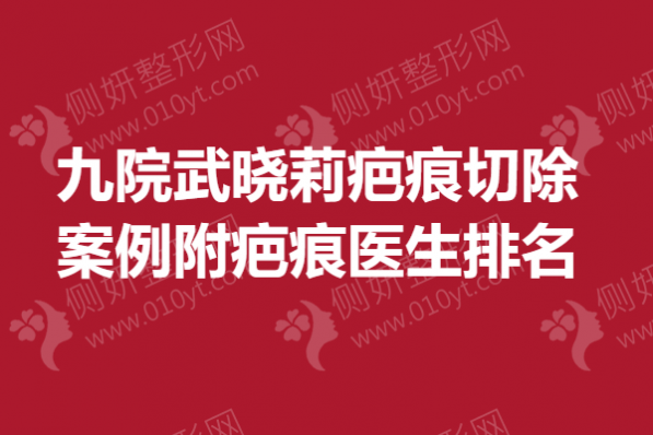 上海九院武晓莉疤痕切除案例附疤痕医生排名