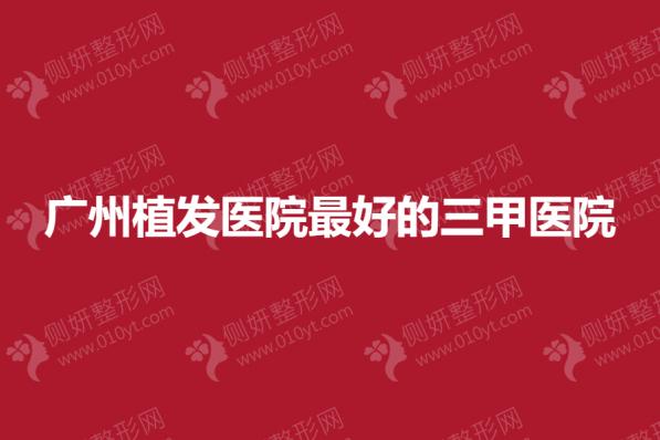 广州植发医院最好的三甲医院