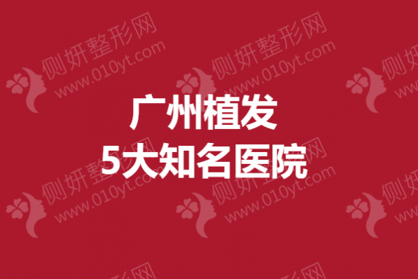 广州植发5大知名医院