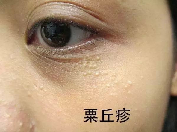 南宁丰乳整形医院排名前十