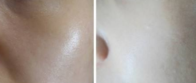 上海美乳整容医院排名前三