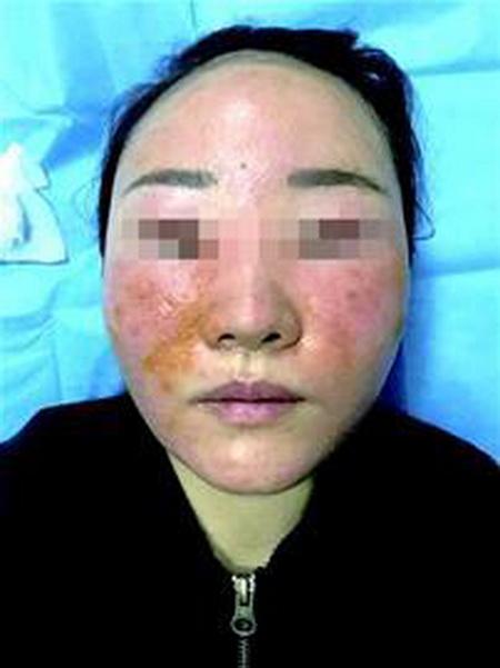 合肥臀部电动负压吸脂整容医院排行榜！