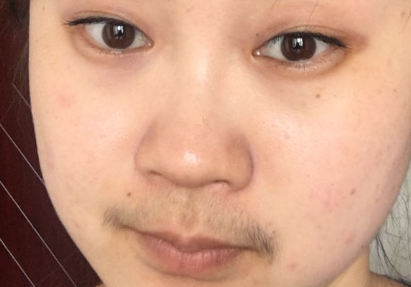 台州抗衰整容医院排行榜！